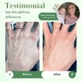 thumbnail image 3 of Theraplex Skin Barrier Balm- Barrier Repair Moisturizer Cream Body Balm Dry, Sensitive Skin - No Parabens or Preservatives, Noncomedogenic and Hypoallergenic - Dermatologist Recommended - 6 Oz, 3 of 9