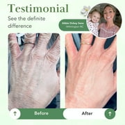 Theraplex Skin Barrier Balm- Barrier Repair Moisturizer Cream Body Balm Dry, Sensitive Skin - No Parabens or Preservatives, Noncomedogenic and Hypoallergenic - Dermatologist Recommended - 6 Oz