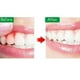 thumbnail image 2 of Spray dental instantáneo para aliviar el dolor dental Afortunado Sencillez, 2 of 5