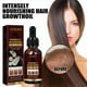 thumbnail image 1 of Solución nutritiva natural para el cabello de aceite de coco para el crecimiento del cabello de 30 ml para el cuidado de las mujeres y los hombres, 1 of 9