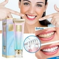 thumbnail image 4 of Laonim Bodyaid Niacinamide Whitening Toothpaste, 4 of 9