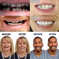 thumbnail image 3 of Artificial Teeth Dentures Temporary Quick Dental Prosthesis Top Perfect Smile Veneers, Repair Your, 3 of 3