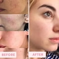thumbnail image 4 of Kaolin Masque de Nettoyage en Profondeur Boue Rose Raffermissant Hydratant, 4 of 8