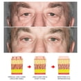 thumbnail image 4 of Gel para ojos Grospe Awaken Peptide, 3 unidades, 15 g, antiarrugas, 4 of 6