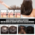 thumbnail image 3 of 3x Biotin Hair Growth Oil Vitamin B7 Hair Essential Oil Treatment Preventing Loss Restorer Essential Oil 30ml, 3 of 5