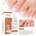 thumbnail image 3 of Esmalte de uñas, regalo para mujeres, suero para el crecimiento y fortalecimiento de las uñas, reparación de uñas, crecimiento de las uñas de los pies, uñas de los pies para reparar uñas dañadas y des, 3 of 5