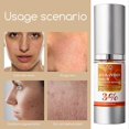 thumbnail image 5 of 1-3x VC Lifting Ampoule, Anti-wrinkle Astaxanthin Essence, VC Anti-Aging Serum for All Skin Types, 5 of 5
