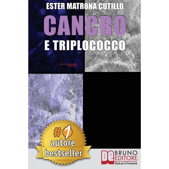 Cancro e Triplococco: Un Unico Microrganismo All'Origine Di Tutti I Tipi Di Cancro (Paperback)