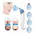 thumbnail image 3 of Extractor Por Succion Puntos Negros, Espinillas Dermasuction Portatíl|, 3 of 5