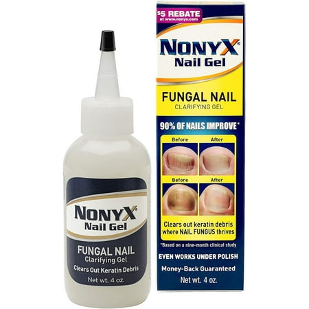 Nonyx Fungal Nail Clarifying Gel Clears Out Keratin Debris, 4 oz, Pack of 5