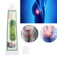 thumbnail image 4 of Ungüento Para Hemorroides, Ungüento Para Aliviar El Dolor, Tratamiento De Desinfección, Crema Para El Cuidado De La Salud, 4 of 7