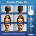 thumbnail image 3 of Tratamiento para el crecimiento del cabello OCVWJKD con 5% de espuma de minoxidil para hombres, 3 of 7