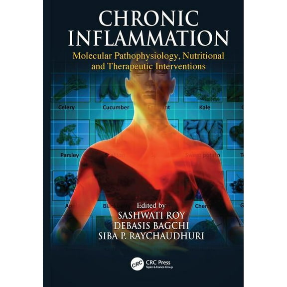 Chronic Inflammation: Molecular Pathophysiology, Nutritional and Therapeutic Interventions, (Paperback)