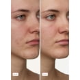 thumbnail image 4 of Peach Slices Super Fade Serum with Niacinamide and Tranexamic Acid, 1 fl oz, 4 of 5