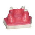 thumbnail image 2 of Milaget Dental Implant Model Display with Practice Soft Gums Dental Implant Training, 2 of 9