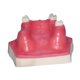 thumbnail image 2 of Modelo maxilar con Typodont Typodont Demostración Modelo de dientes Muestra de ayuda para la enseñanza de la capacitación en implantes dentales, 2 of 8