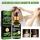 thumbnail image 4 of Suero avanzado para el crecimiento del cabello. Promueve, hidrata, fortalece el cabello y nutre el cuero cabelludo. Para hombres y mujeres. 30 ml de aceites esenciales., 4 of 5