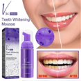 thumbnail image 3 of Tooth Whitening Mousse Foam Tooth Whitening Cottector Professional Teeth Stains Removal Toothpaste, 3 of 5