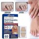 thumbnail image 3 of 60pcs Toenail Fungus Treatment Stickers Ingrowning Toenail Nail Repair Patch, 3 of 5