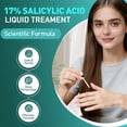 thumbnail image 3 of Líquido para eliminar verrugas BYT BANGYTONG 30 ml con ácido salicílico al 17%, 3 of 8