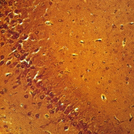 Mammal Cerebrum Pyramidal Neurons  Sec. 7 M Silver Stain Microscope Slide price history on PriceWatchPro