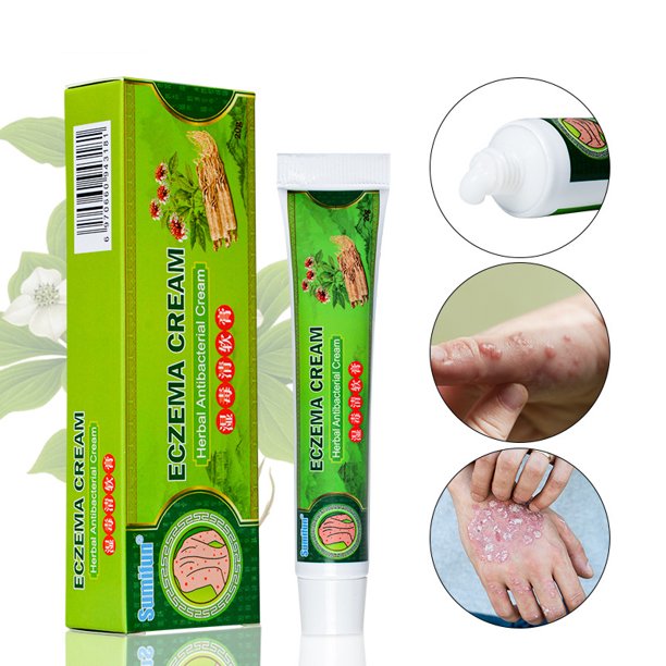 Eczema Cream, Dry Skin, Eczema Treatment , Calendula Cream, Dermatitis