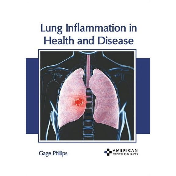Lung Inflammation in Health and Disease (Hardcover)