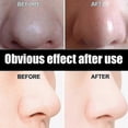 thumbnail image 4 of Mascarilla para eliminar puntos negros que limpia los poros de forma suave y profunda para succionarlos -7354371456373, 4 of 5
