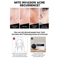 thumbnail image 4 of Jabón de ácido salicílico jabón de limpieza de ácido salicílico Eliminación de espinillas Limpieza profunda Control de aceite Exfoliante de poros portátil para el hogar ANGGREK Otros, 4 of 8