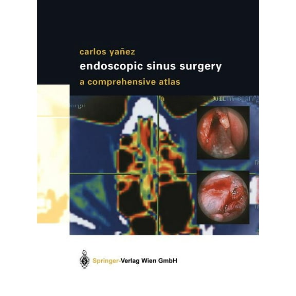 Endoscopic Sinus Surgery: A Comprehensive Atlas, (Paperback)