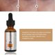 thumbnail image 4 of Suero de vitamina C ANGGREK ISNER MILE antienvejecimiento 30ml, 4 of 8