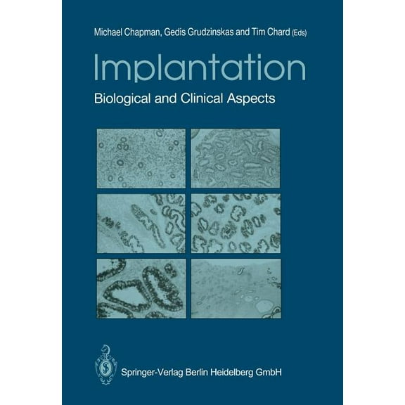 Implantation: Biological and Clinical Aspects, (Paperback)