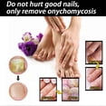 thumbnail image 4 of 1-6pcs EELHOE 30ml Toenail & Fingernail Repair Drops Nail Care Renewal for Thick, Damaged &, 4 of 5
