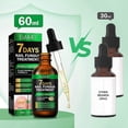 thumbnail image 5 of Nail Fungus Treatment Oil for Toenail & Cuticle Care, 7-Day Ginger Formula, 1/2/3 Pieces Fungal Nail Solution, 5 of 5