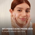 thumbnail image 5 of Gel hidratante facial Neutrogena Ultra Suave 150 ml propenso al acné, 5 of 5