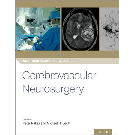 UPC: 9780190887728 | Neurosurgery by Example: Cerebrovascular Neurosurgery (Paperback)