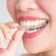 thumbnail image 4 of Soportes de ortodoncia de dientes de silicona Protector de bandeja de blanqueamiento dental retenedor, 4 of 8