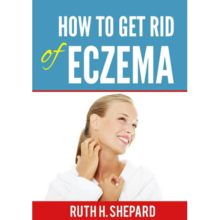 How to Get Rid Of Eczema - eBook (The Best Way To Get Rid Of Eczema)