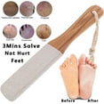 thumbnail image 3 of LQQBOX Foot Pumice Stone for Feet Callus Remover, Double Sided Foot Scrubber with Handle, Heel Scraper Pumice Stone in Shower Corn Hard Skin Cracked Feet Care Tools - 2 Pcs, 3 of 7