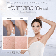 Project E Beauty SmoothPro+ IPL Laser Hair Removal Device | FDA Cleared Laser Hair Removal Device | Intense Pulsed Light | Permanent Hair Reduction