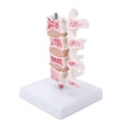 thumbnail image 4 of Modelo De Osteoporosis De La Columna Vertebral, Modelo De Anatomía Modelo Anatómico De La Columna Vertebral Para La Enseñanza Para La Exposición Del Modelo Para Una, 4 of 8