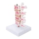 thumbnail image 4 of Modelo De Osteoporosis De La Columna Vertebral, Modelo De Anatomía Modelo Anatómico De La Columna Vertebral Para La Enseñanza Para La Exposición Del Modelo Para Una, 4 of 8