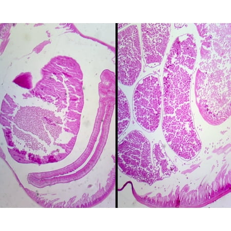 Slide   Ascaris Lumbricoides  Male and Female; Cross Section price history on PriceWatchPro