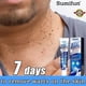 thumbnail image 3 of Wart Removal Ointment Instant Blemish Removal Gel 20g, 3 of 3