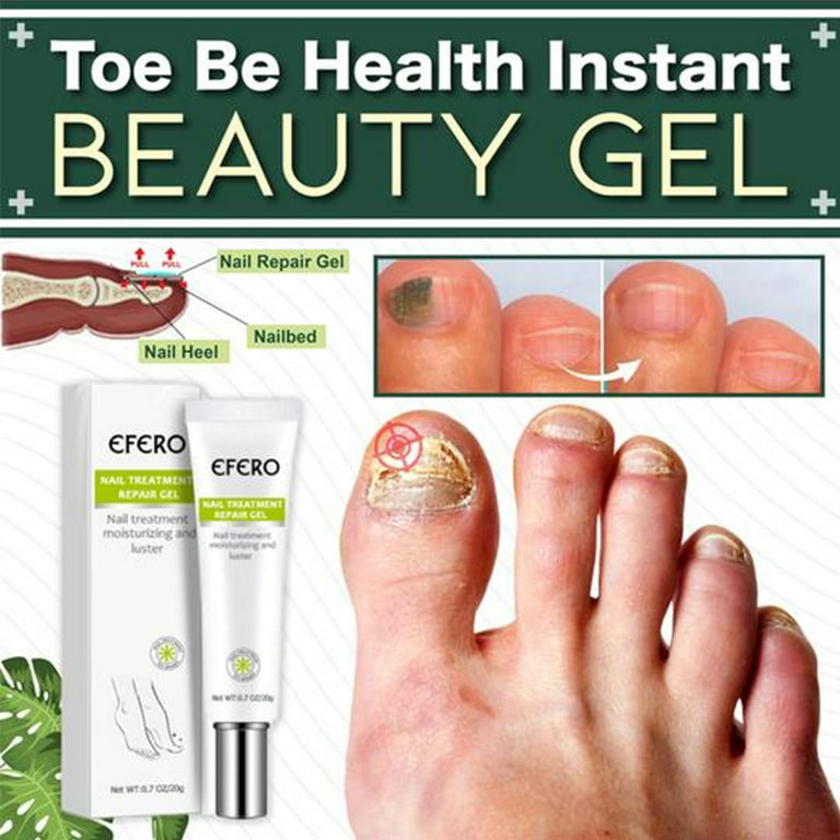 RuiKe Efero Anti-Fungal Nail Gel Anti-Infection Nails Treatment ...