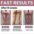 thumbnail image 4 of Thigh Scu, 4 of 5