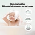 thumbnail image 2 of Green Lice Shampoo (A) $ Lice Shampoo Children's Head Lice Shampoo Lice Cleaner Remove Pubic Lice Stemona Tincture Little Girls Hair Lice Egg Remover, 2 of 5