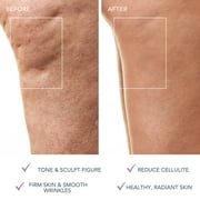 FOREO BEAR™ 2 Body Microcurrent Massager, 10 Intensities, Anti-Cellulite, Body Sculpting, Lavender