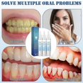 thumbnail image 3 of 3X Gum Repair Gel Rebuilding Strengthen Whiten Remove Breath Inflammation Oral Tooth Bad Protect Anti Gingival Stains Recessio, 3 of 4