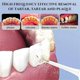 thumbnail image 5 of Limpiador de dientes eléctrico portátil resistente al agua, A, blanco, 5 of 5